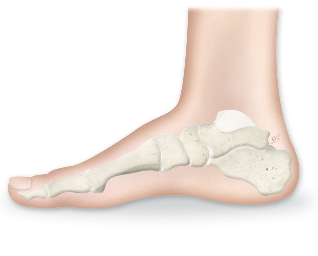 پس کاووس (Pes cavus) یک اصطلاح توصیفی برای مورفولوژی پا است که با افزایش غیر طبیعی قوس کف پا مشخص می شود و با تغییر شکل در قسمت جلوی پا ، میانی پا ، پشت پا یا ترکیبی از این محل ها باشد. در حالی که پس کاووس یک یافته رایج است که تقریباً در 10٪ از جمعیت عمومی رخ می دهد، می تواند نشانه ای از یک بیماری نورولوژیک زمینه ای نیز باشد.