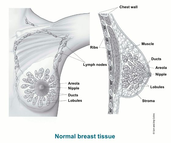 اصطلاح "سرطان پستان" به توموری بدخیم گفته می شود که از سلول های پستان ایجاد شده است.  با گذشت زمان ، سلول­های سرطانی می توانند به بافت سالم پستان حمله کرده و به غدد لنفاوی زیربغل و اندام­های دیگر راه پیدا کنند.