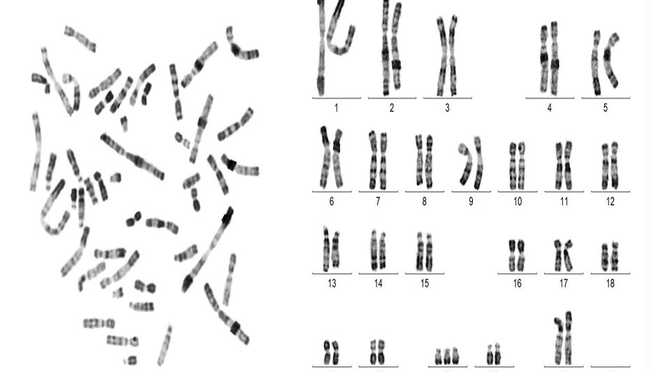آزمایش کاریوتایپ تعداد، شکل و سایز کروموزوم های شما را مشخص می کند.  کروموزوم ها در واقع  محتوای ژنی شما و بخشی از سلول هستند که از پدر و مادر به ارث میرسند. ژن ها ناقل اطلاعات هستند که ویژگی های شما را مانند قد و رنگ چشم شما را مشخص می کند. هر فردی به صورت نرمال 46 کروموزوم دارند که 23 جفت در هر سلول می باشد. یک جفت از کروموزوم ها از پدر  و یک جفت آن از مادر به ارث می رسد. اگر شما دارای تعداد کروموزوم کمتر یا بیشتر از 46 تا باشید این می تواند نشان دهد که شما بیماری زنتیکی دارید.آزمایش کاریوتایپ اغلب برای کمک به پیدا کردن نقص های ژنتیکی در یک کودک تکامل یافته می باشد.