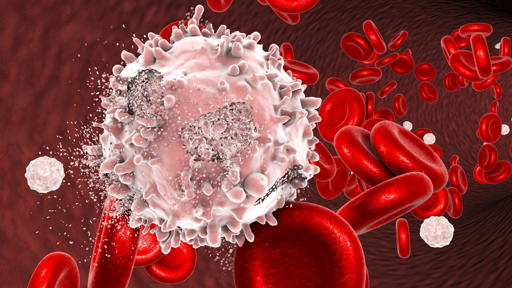 Destruction of leukaemia cell, conceptual image. 3D illustration which can be used to illustrate blood cancer treatment
Usage: Journal Inside
00740_020_004 (2017) Publikationsname / Publikationsnummer / E-Tag TT.MM.JJJJ (optional)
 *** Local Caption *** © Kateryna_Kon / stock.adobe.com