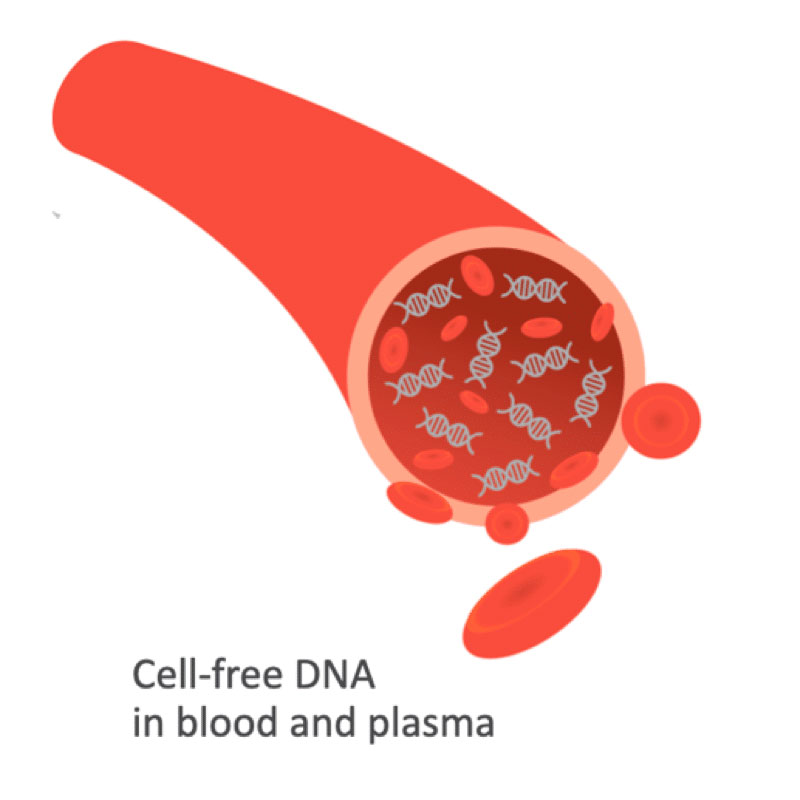 غربالگری پیش از تولد  cell- free DNA که به عنوان یک آزمایش غربالگری پیش از تولد غیرتهاجمی نیز شناخته می شود، روشی برای غربالگری ناهنجاری های کروموزومی مشخص در جنین می باشد. در این آزمایش در واقع قطعات کوچک DNA جنینی که در جریان خون مادر در حال گردش هستند مورد بررسی قرار می گیرند. 