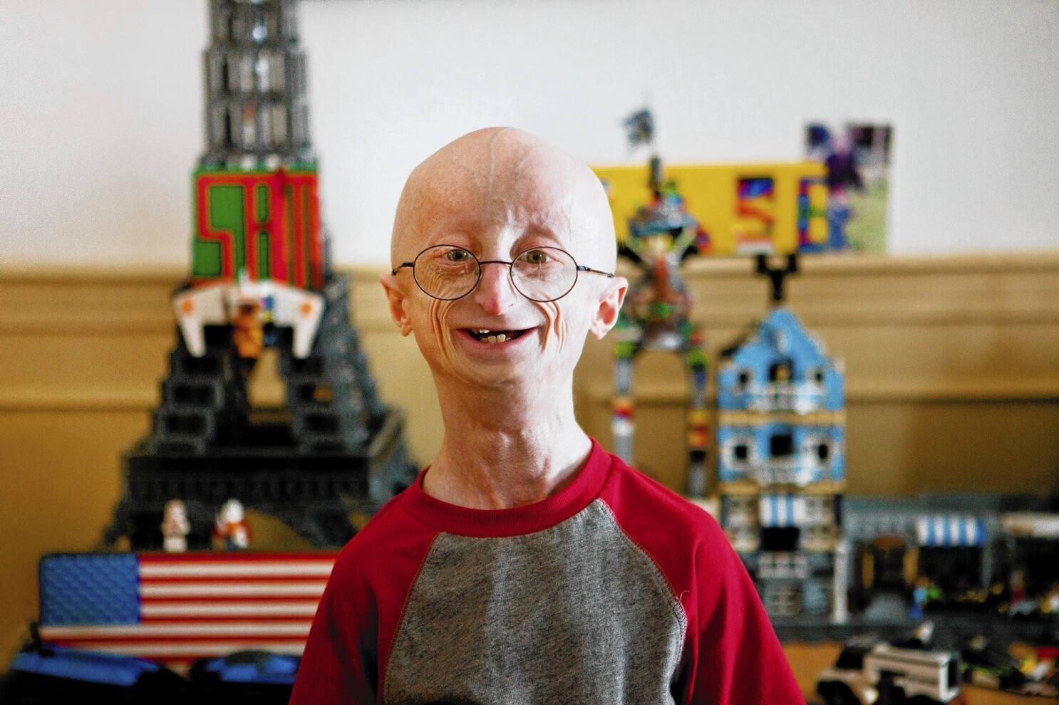Progeria (pro-JEER-e-uh) یا پروجریا که همچنین به عنوان سندرم هاچینسون-گیلفورد شناخته می شود، یک اختلال ژنتیکی بسیار نادر و پیشرونده است که باعث می شود کودکان به سرعت پیر شوند و از دو سال اول زندگی شروع می شود.
کودکان مبتلا به پروجریا معمولا در بدو تولد طبیعی به نظر می رسند. در طول سال اول، علائم و نشانه هایی مانند رشد آهسته و ریزش مو شروع می شود.

