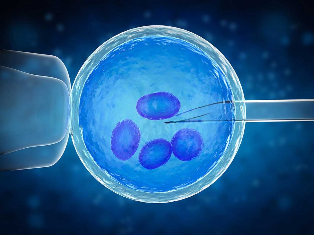 مرحله اول باروری آزمایشگاهی (IVF) استخراج تخمک از تخمدان‌ها تحت کنترل سونوگرافی